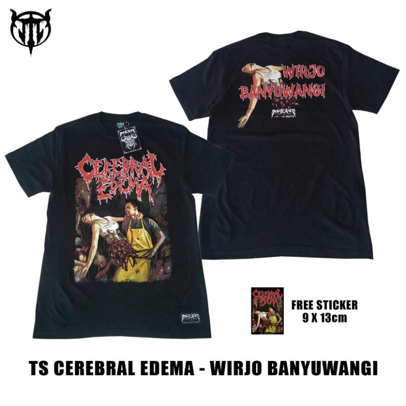 Áo thun ban nhạc Edema Ts Cerebral - Wirjo Banyuwangi