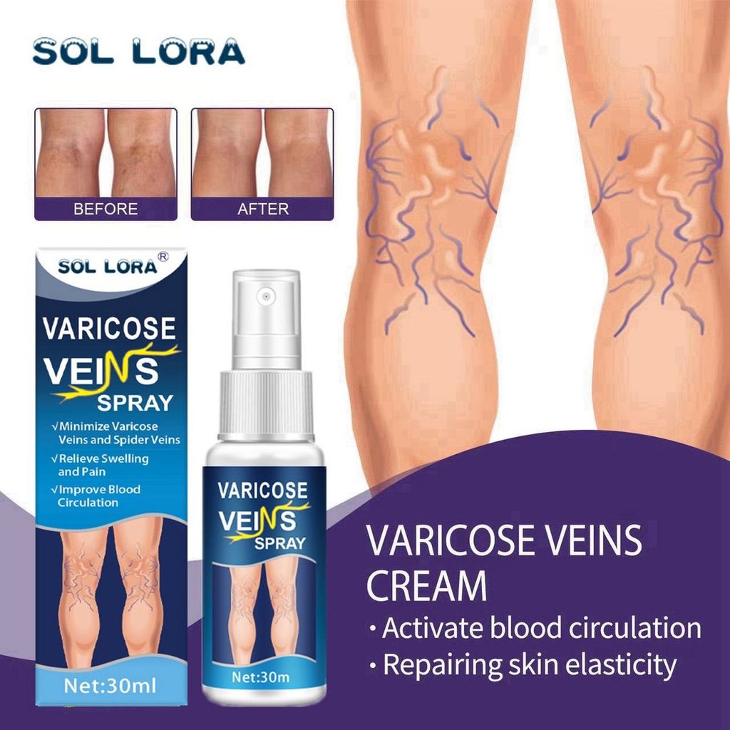 New Product#Female Genuine Vein Spray Leg Massage Earthworm Leg Pulse Health Care Spray Portable Bea