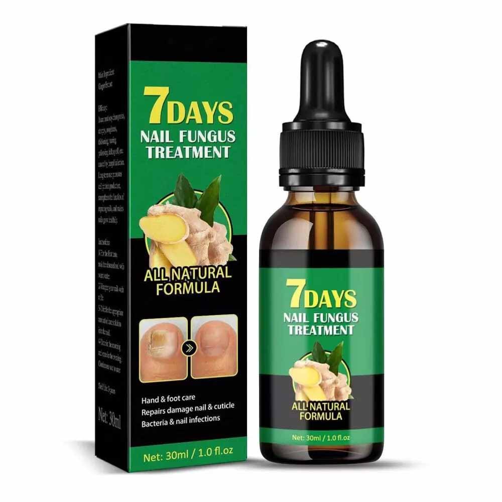 Ginger Nail Treatment 30ml Nail Growth Serum, Ginger Cuticle Care Oil