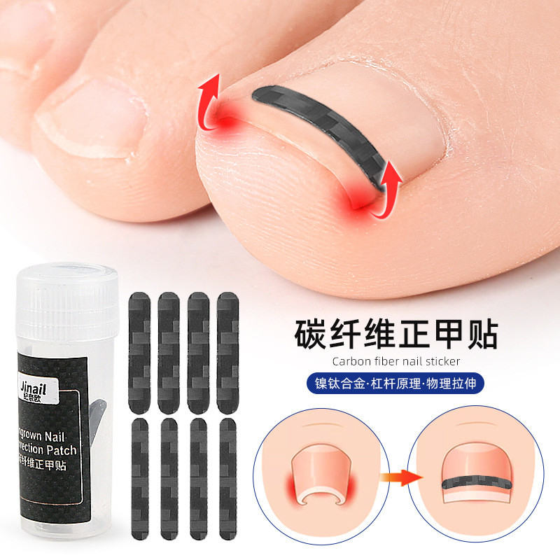 Sợi Móng Miếng Dán Móng Tay Rãnh Móng Tay Inlay Móng Chân Móng Tay Inlay Móng Chân Miếng Dán Móng Ta