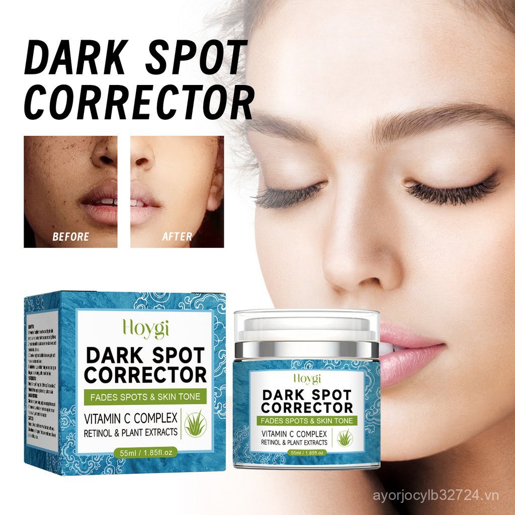Hoygi Dark Spot Fade Cream Fade Dark Spots Chloasma Repair Dull Skin Even Skin Tone Whiteening Brigh