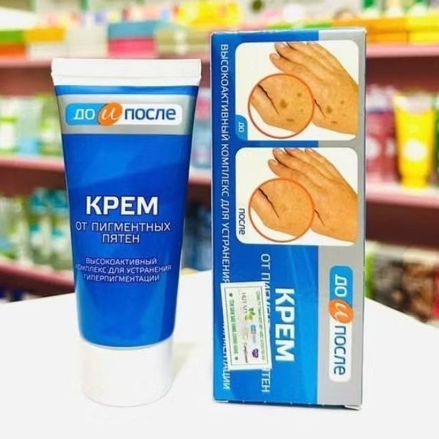 Kem bôi đồi mồi Kpem nhập khẩu chính hãng Nga có sẵn