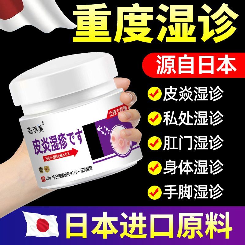 Kem chàm Viêm da Viêm da Eczema Mồ hôi Herpes Loại bỏ sự mất nét Eczematic Nettle Herpes Da ngứa Kem