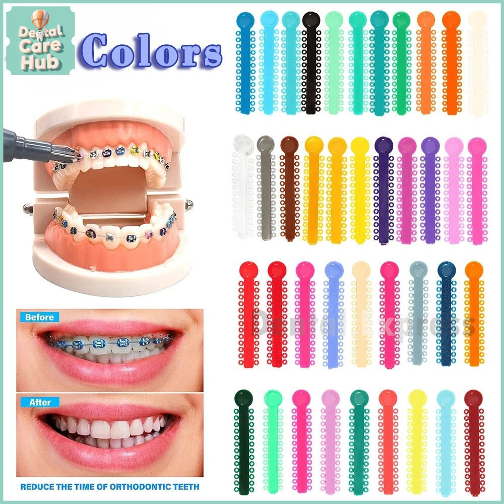 Chun niềng răng nhiều màu, thun niềng răng chỉnh nha, dây chun đơn gắn mắc cài Dental Care Hub
