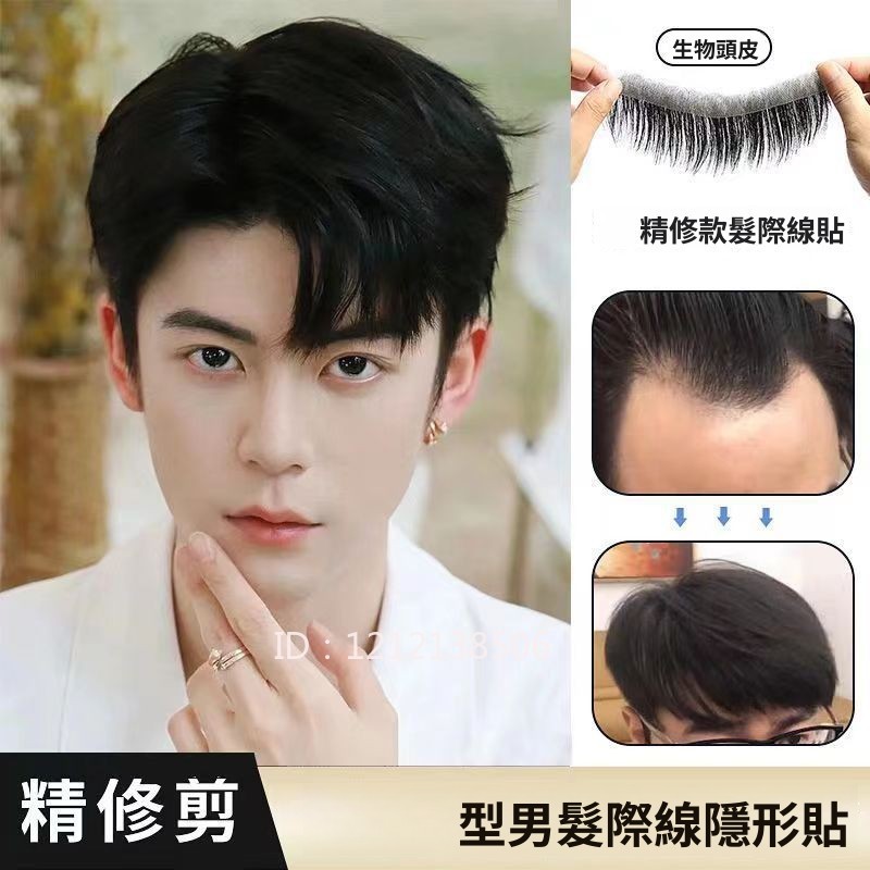 M Một Phần Miếng Dán Tóc Giả Miếng Dán Nam Tóc Giả Miếng Dán Vô Hình Liền Mạch Miếng Dán Tóc Thật Hì