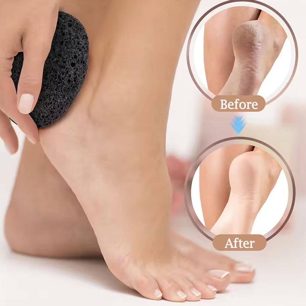 [TOTO] Tệp chân đá bọt tẩy tế bào chết để loại bỏ vết chai Dụng cụ chà ngón chân thô M3s9 [TOTO]