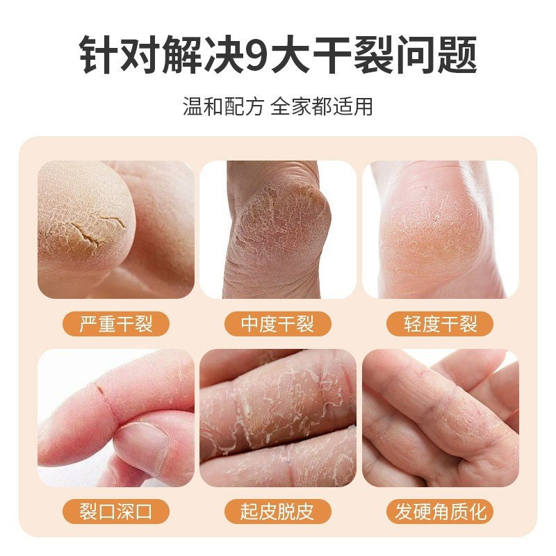 Hot Sale~Zhang Zhongjing Horse Ointment Hand Foot Anti-Dry Cracking Cream Autumn Winter Heel Anti-Cr