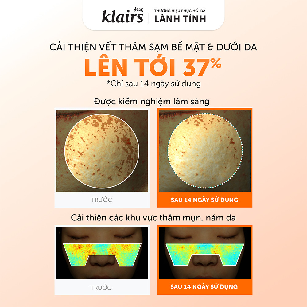 Nước hoa hồng Dear, Klairs Freshly Juiced Vitamin Essence Toner hỗ trợ làm sáng da 180ml [FS] | BigBuy360 - bigbuy360.vn