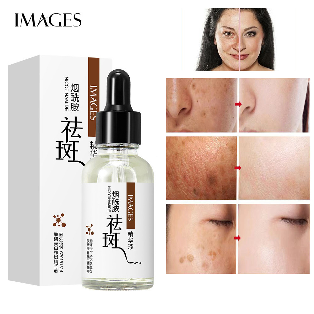 Hình ảnh của Serum làm trắng da chống tàn nhang, Niacinamide Dark Spot Serum, Tinh chất dưỡng ẩm mặt