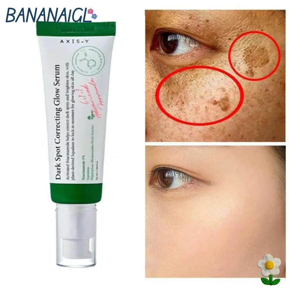 BANANA1GL Dưỡng Ẩm, Làm Sáng Không Greasy Làm Mới, Tàn Nhang Hiệu Quả Phai Màu Điểm Dưỡng Ẩm Da Tàn 