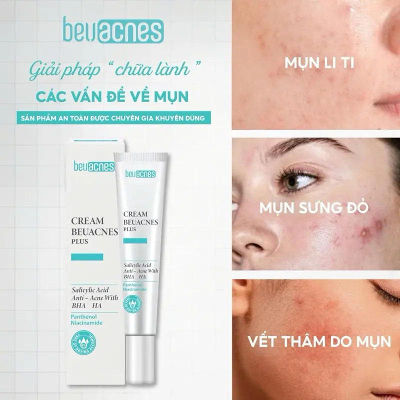 Kem giảm mụn nhanh 24h BEUACNES PLUS mụn trứng cá, chiết xuất rau má, hỗ trợ mờ thâm mụn 15g
