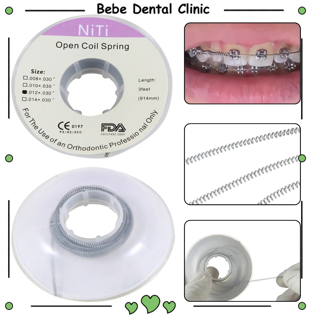 3Feet / Cuộn Nha Khoa NiTi Mở Cuộn Dây Lò Xo Chỉnh Nha Dây 914mm / Cuộn