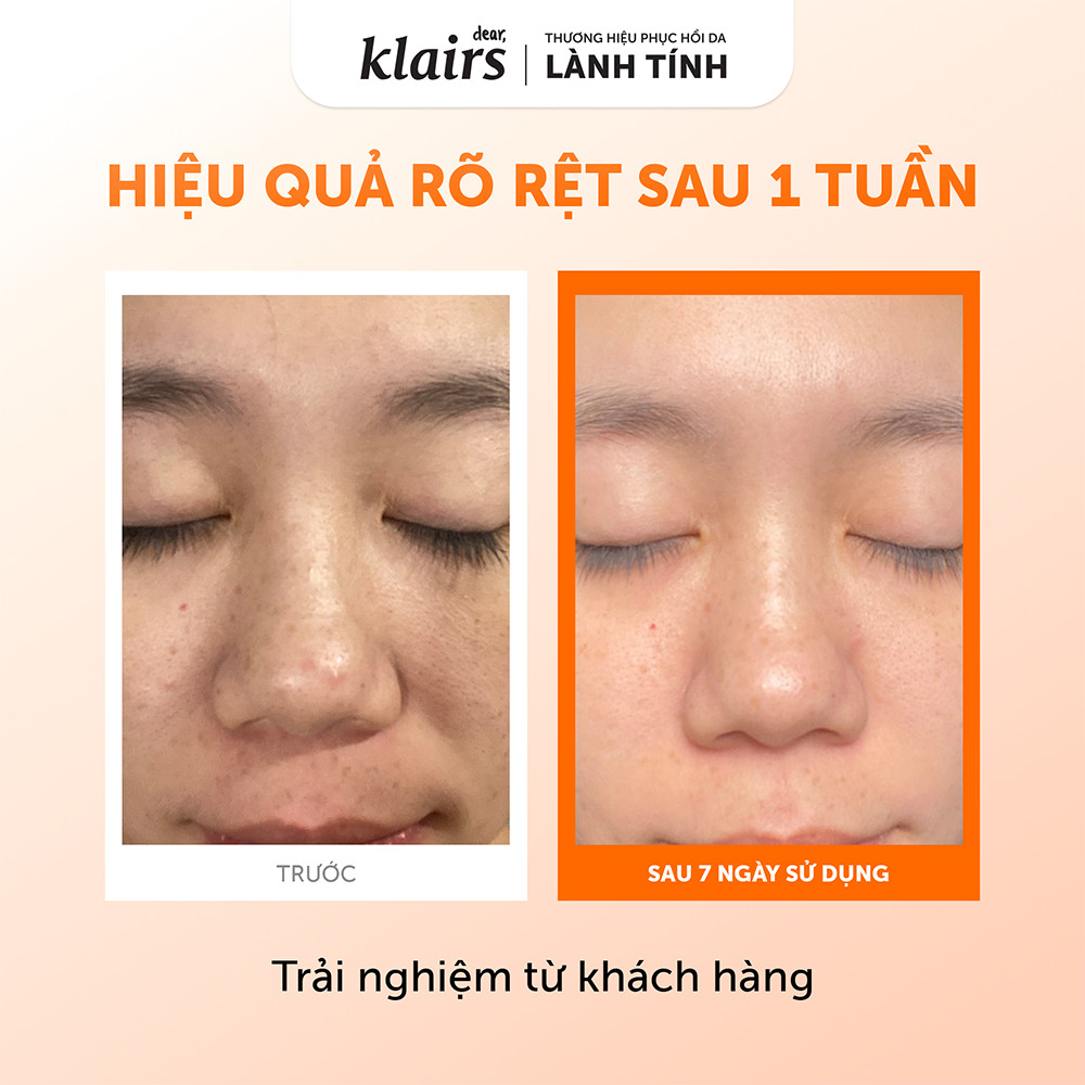 Nước hoa hồng Dear, Klairs Freshly Juiced Vitamin Essence Toner hỗ trợ làm sáng da 180ml [FS] | BigBuy360 - bigbuy360.vn