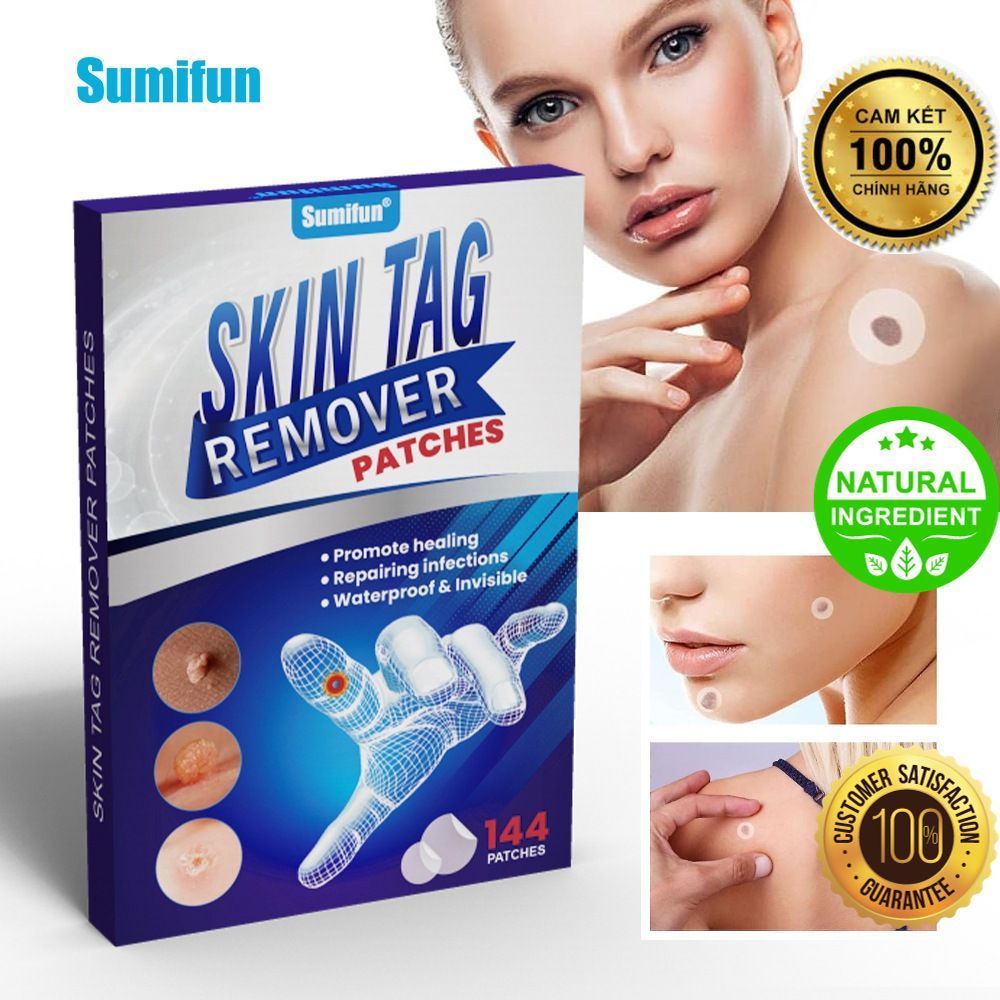 144 Miếng Dán Skin Tag Remover – Loại Bỏ Nốt Ruồi Thịt, Mụn Thịt, Mụn Cóc An Toàn GIÁ SIÊU MỀM  |9W