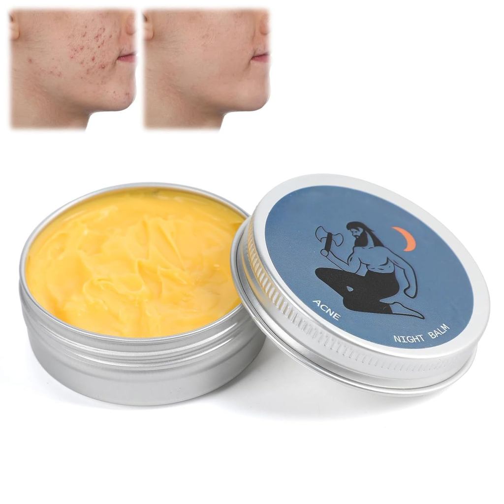 Norse Organics Acne, Norse Organics Acne & Redness Killer, Norse Organics Acne Balm, Acne Clearing C
