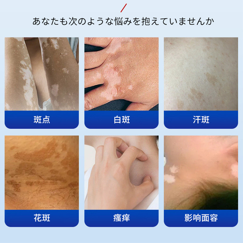 Kurai Shikawa White Mad Health Cream Làm dịu da Vết trắng Da Ngứa mồ hôi Điểm khó chịu Chăm sóc bên 