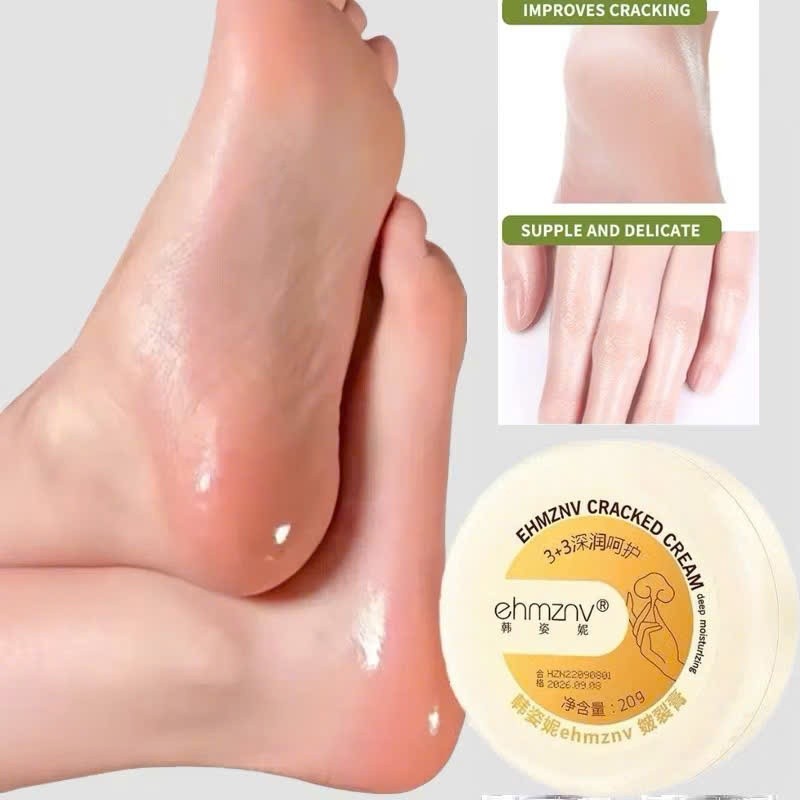 Kem Dưỡng Ẩm Gót Chân HEYXI - Kem Dưỡng Ẩm HEYXI Làm Mềm Da, Cấp Ẩm Chống Nứt Nẻ Gót Chân