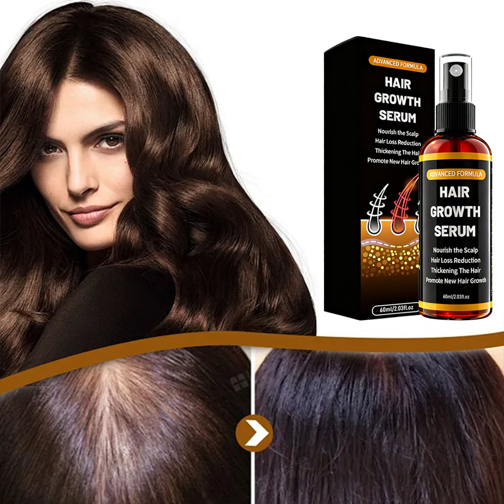 Hair Tonic Hair Growth Spray Serum Hair Treatment Effective Anti Hair Loss