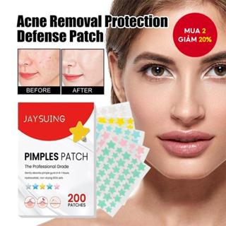  200 miếng dán hình ngôi sao | Nhãn dán chăm sóc da loại bỏ mụn vô hình đầy màu sắc cho mặt | Dụng cụ trang điểm làm đẹp điều trị tại chỗ 