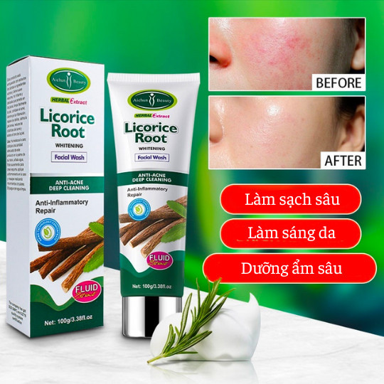 Sữa Rửa Mặt Aichun Beauty phù hợp da dầu, da mụn, da lỗ chân lông to, Sạch Mụn Tạo Bọt Mịn