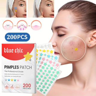  Miếng dán mụn,Miếng Dán Mặt Điểm,hỗ trợ giảm mụn lành sẹo mụn dùng mỗi ngày dán mụn ban ngày & ban đêm 200Pcs 