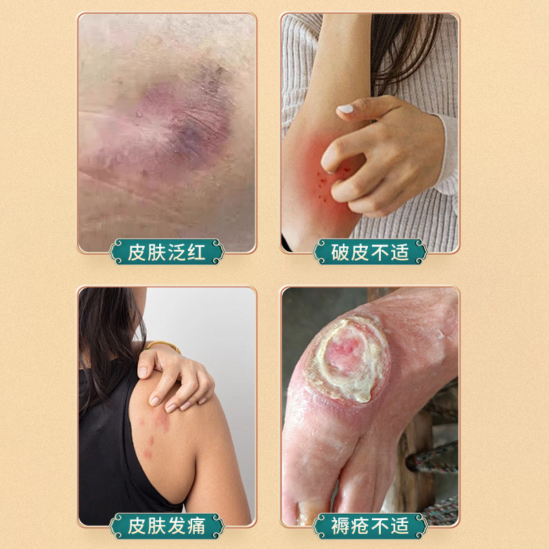 Fulong Fujiwara Fujiwara Matsore Cream Chiết xuất thảo dược Chăm sóc nhẹ nhàng Kem chăm sóc da Giảm 