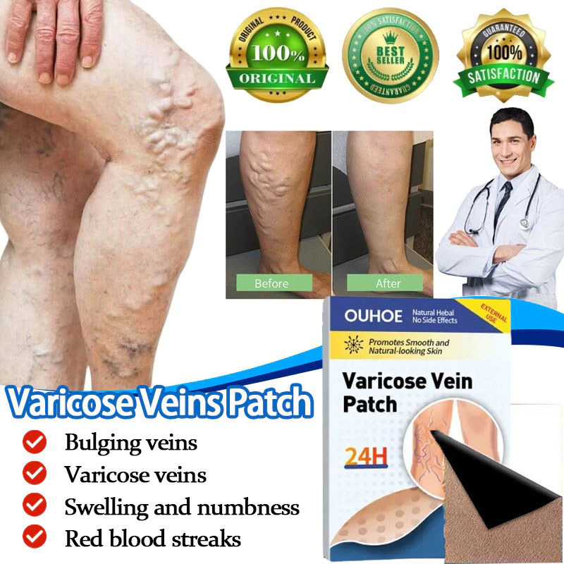 Miếng Dán Chống SAY TÀU XE Motion Sickness Patch Giảm Triệu Chứng Buồn Nôn, Chóng Mặt N1