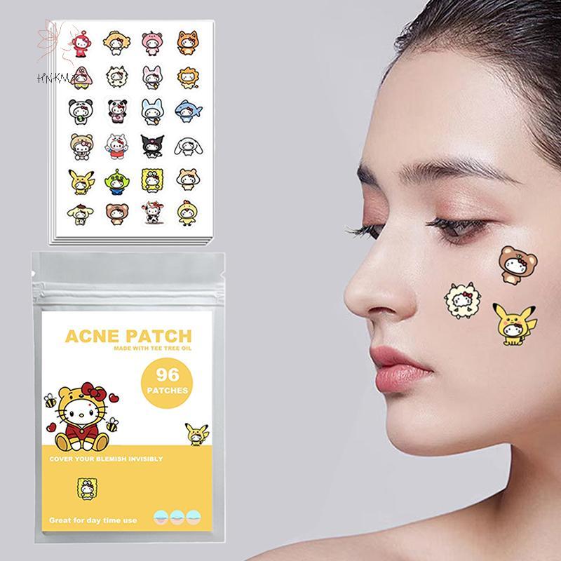 HNKMP 96 Miếng Dán Mụn Hoạt Hình Sanrio HelloKitty Hình Mụn Miếng Dán Vô Hình Mụn Loại Bỏ Mụn Miếng 