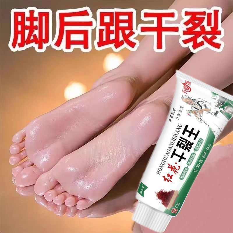 New Product#[Cracked Skin King]Heel and Toe Crack Repair Cream for Dry and Cracked Feet and Hands, A