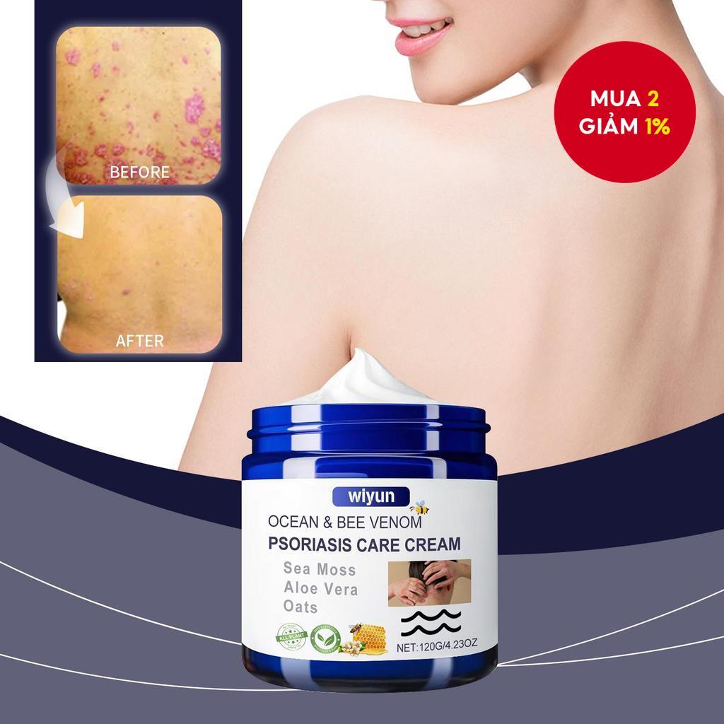 [HOT] Kem làm dịu nọc ong Ocean Natural, Kem làm dịu chàm nọc ong Ocean Natural, Kem chăm sóc nọc on