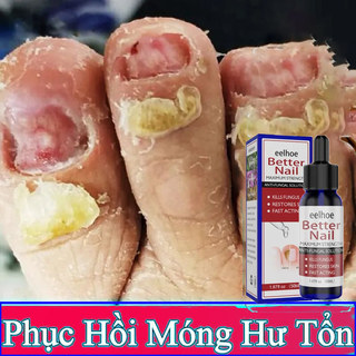 Serum Nấm Móng Tay Chân  Hết Sạch Nấm, Bọng Móng, Hư Khoé, Nước Ăn Tay Chân, Dưỡng Cứng Móng