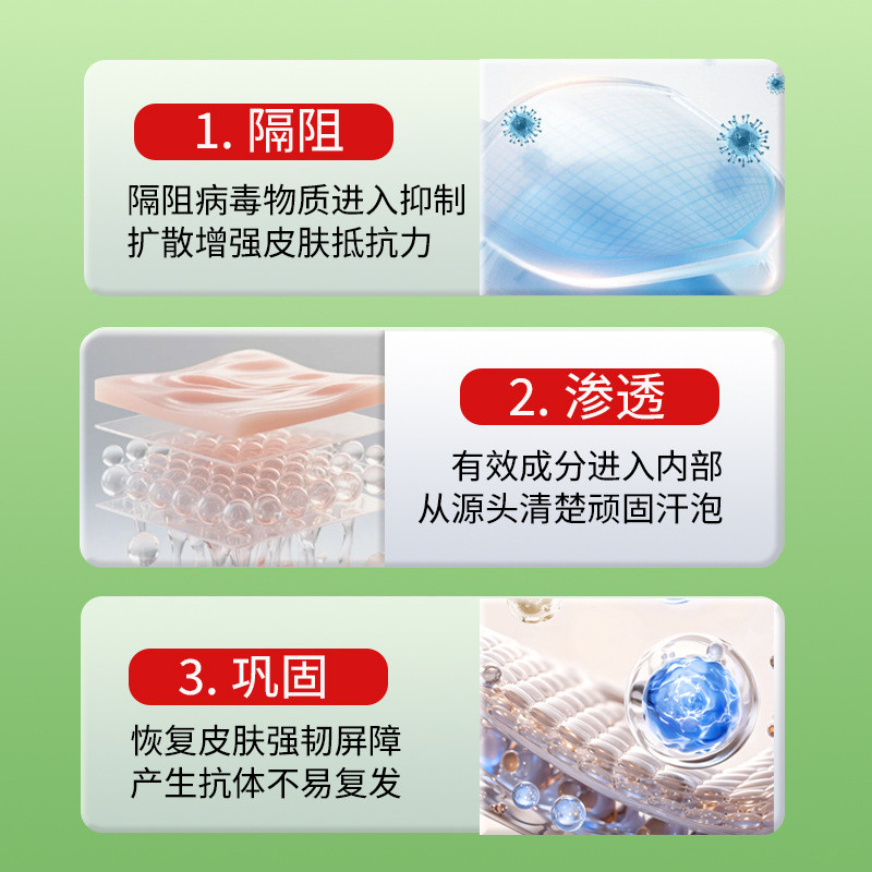 Herpes Cream Hand Foot Peeling Herpes Ngứa Vỉ Nhỏ Mồ Hôi Herpes Chăm Sóc Sử Dụng Bên Ngoài Kem Giảm 