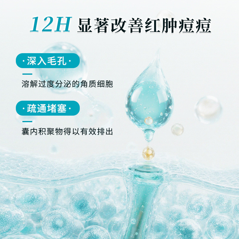 Gel trị mụn 2% Salicylic Acid Gel loại bỏ mụn 0513