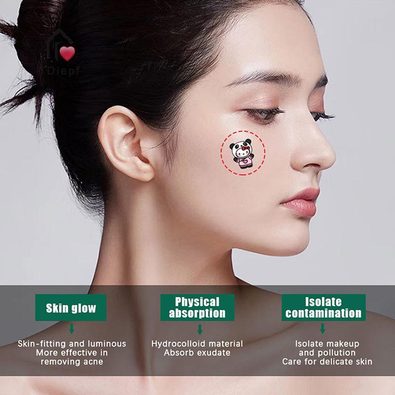 [TDiepf] 96 Miếng Dán Mụn Hoạt Hình Sanrio HelloKitty Hình Mụn Miếng Dán Vô Hình Mụn Loại Bỏ Mụn Miế