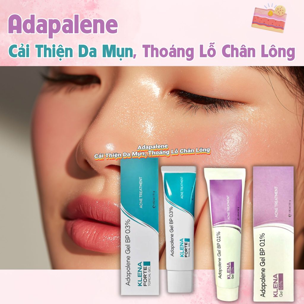 Klena Forte 0.1% Adapalene - Gel Hỗ Trợ Cải Thiện Da Mụn, Gel Làm Thoáng Lỗ Chân Lông, Giảm Bít Tắc 