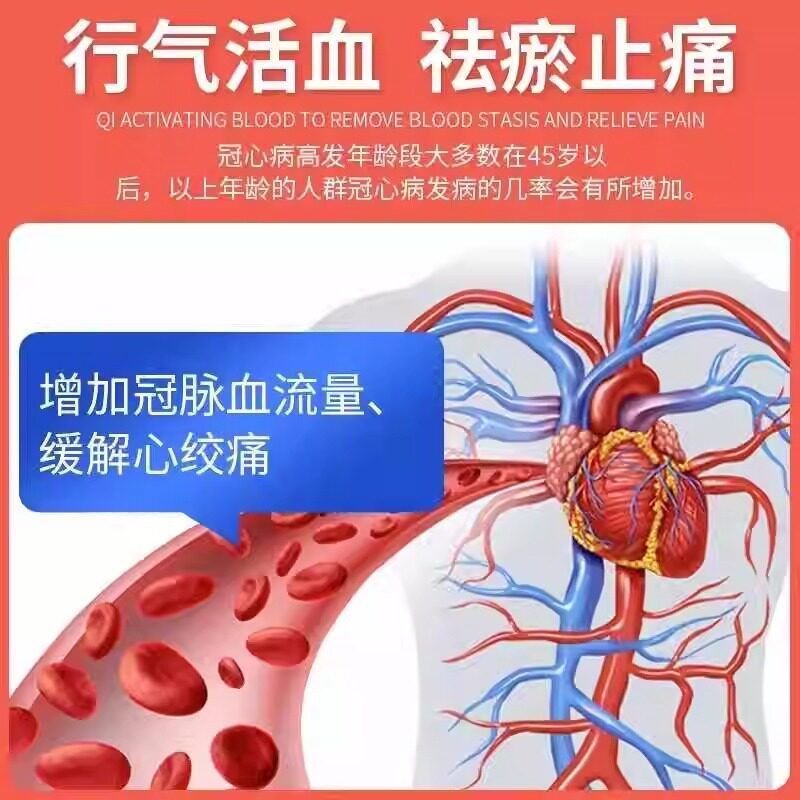 Longyuan Nitrate Glycerin Viên 0.5mg * 30 Viên / Chai * 1 Chai / Hộp Loại Bỏ Axit Glycerin Dưới Lưỡi