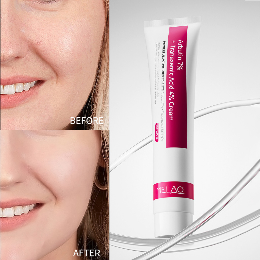 7% Arbutin Tranexamic Acid Cream Làm trắng phai màu Dưỡng ẩm Dưỡng ẩm Arbutin Cream Tube Lotion