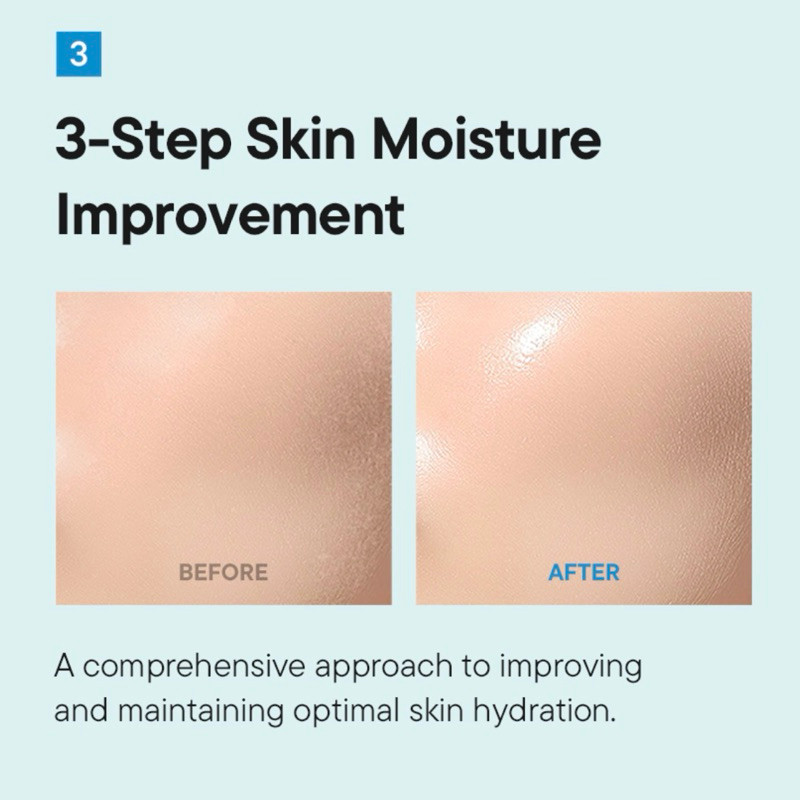 IUNIK Beta-Glucan Power Moisture Serum – Serum dưỡng ẩm để dưỡng ẩm sâu & dưỡng da 50ml