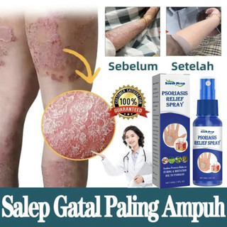 Xịt Bôi Nấm Ngứa Viêm Da Cơ Địa NHẬT BẢN Hắc Lào, Tổ Đỉa, Vẩy Nến, Á Sừng, Lang Ben Hiệu Quả