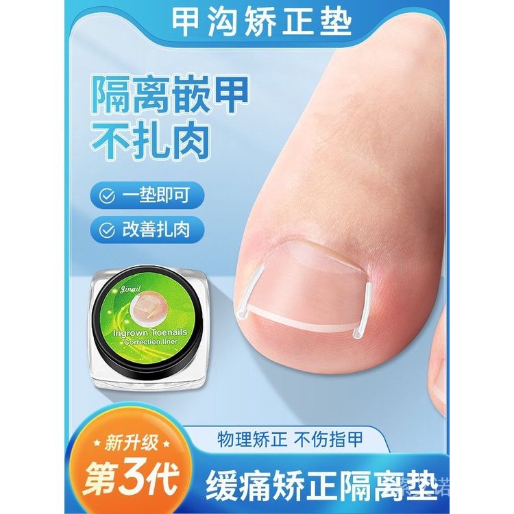 ((Mới) Dụng cụ làm móng Paronychia Dụng cụ chỉnh sửa móng tay tạo tác Paronychia Móng tay mọc ngược 