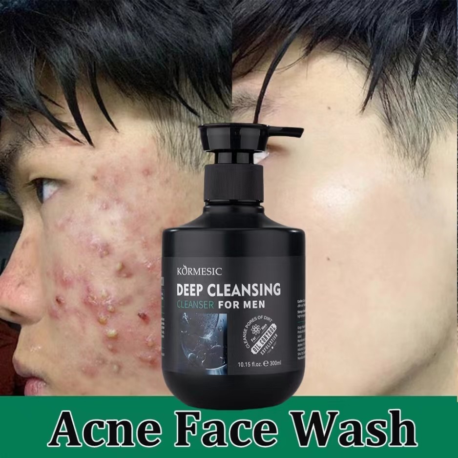 Sữa rửa mặt Nam trắng da sạch mụn kiểm soát dầu và làm sạch sâu Sửa rửa mặt trắng da cho da sáng bóng săn chắc