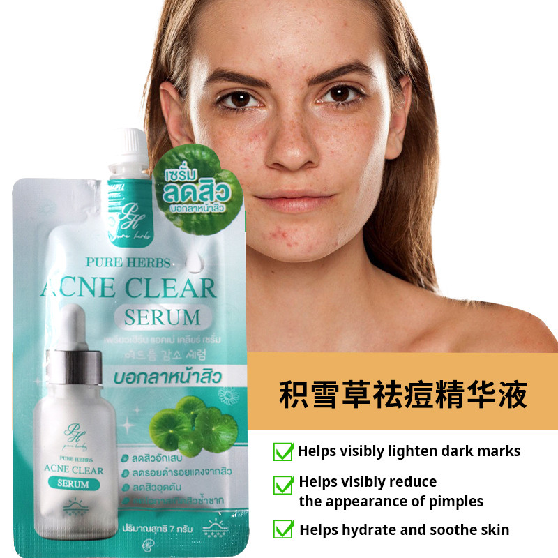 711 Mua Tinh chất loại bỏ ACNE RH-ACNE-CLEAR Loại bỏ ACNE Pit Marks ACNE Thu nhỏ lỗ chân lông Thái L