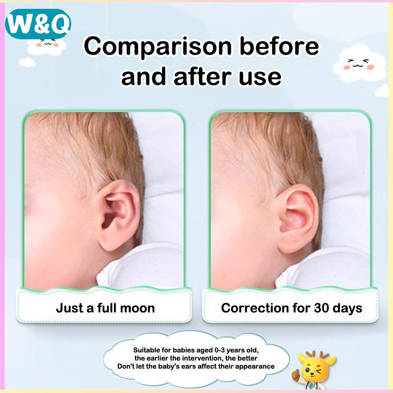 W & Q Baby Auracle Hỗ trợ bên ngoài Auricle Corrector Protruding Baby Ear Corrector Baby External Au