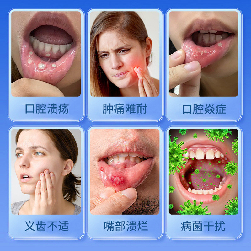 Oka Makoto Phụ Kiện Miệng Lỏng 30Ml Xịt Lưỡi Oka Makoto Phụ Kiện Miệng Lỏng 30Ml Xịt Lưỡi20251208