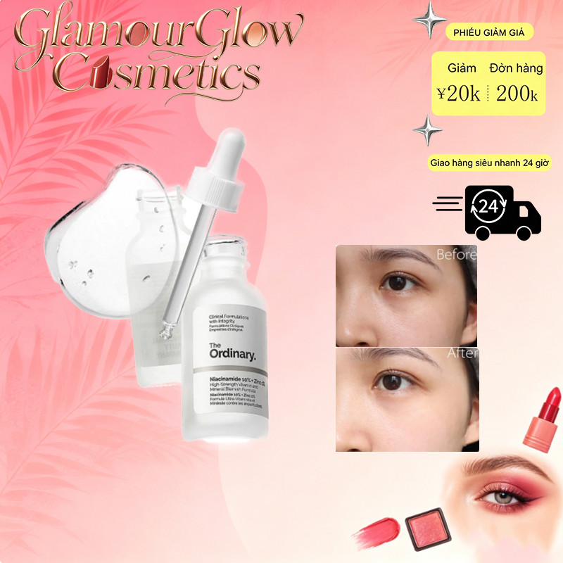 The Ordinary Niacinamide 10% + Zinc 1% – Serum se khít lỗ chân lông, giảm mụn, kiểm soát dầu & làm sáng da hiệu quả