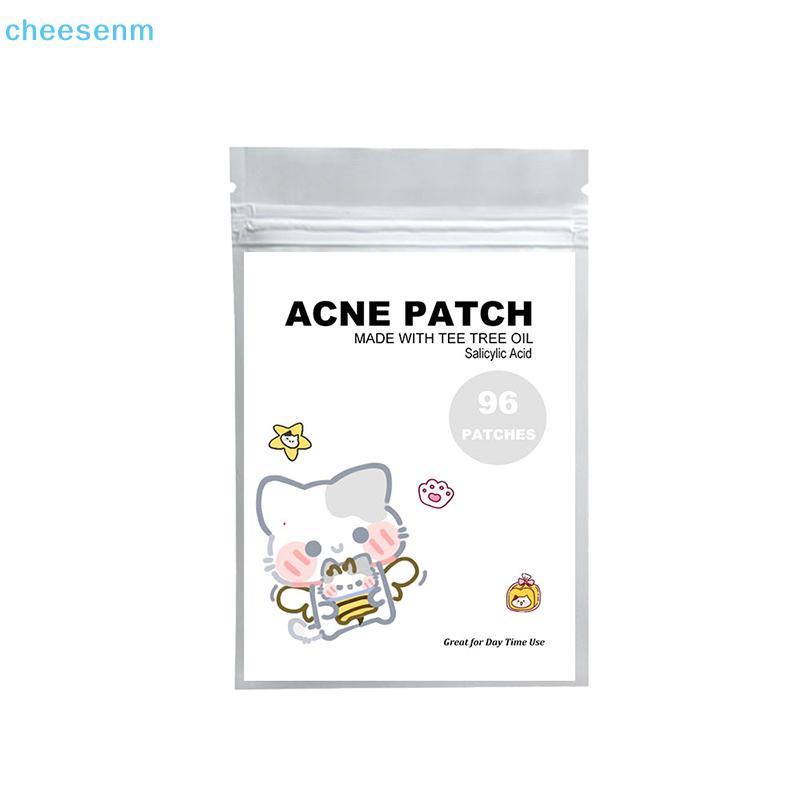 Cheenm 96 Miếng Dán Mụn Hình Mèo Hỗ trợ giảm mụn Miếng Dán Vô Hình Mụn Loại Bỏ Mụn Miếng Dán Chăm Só