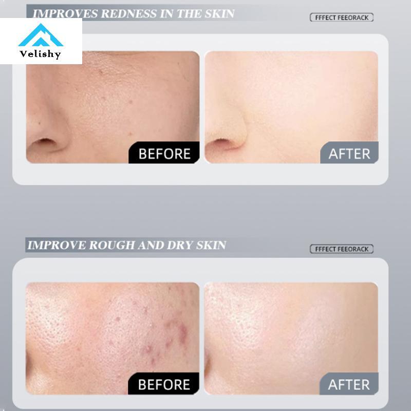 Kem dưỡng ẩm Velishy 345 Kem dưỡng ẩm cho da Chăm sóc làm dịu da