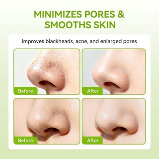 10 Miếng dán mũi LANBENA làm sạch mụn đầu đen