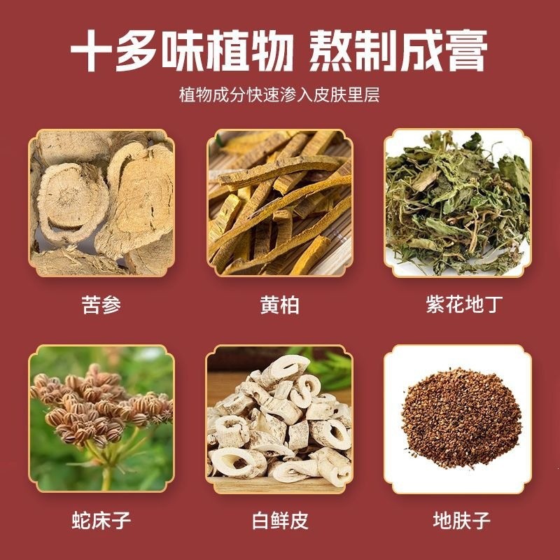 Miaojia Fungus King Kem chống ngứa Công thức nhẹ Chăm sóc ngứa da Miaojia Fungus King / sansi '5.28