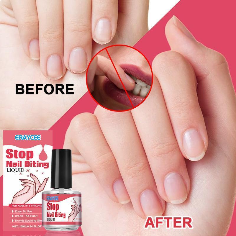 10ml Stop Nail Biting Treatments Liquid Kids Baby Stop Bitter Liquid Cuticle Care Supplies Bitter Na